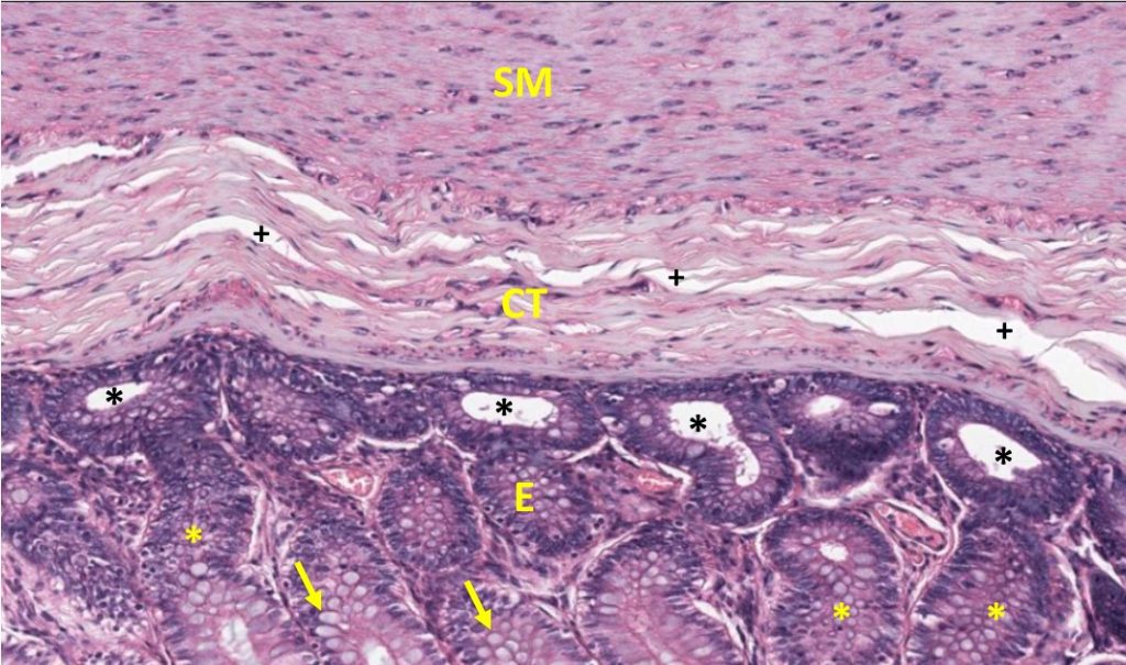 Introduction to Cell, Tissue Ultrastructure – UWSOM WWAMI ...