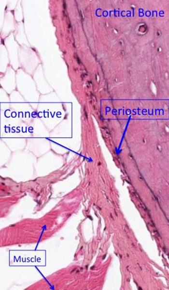 Bone – UWSOM WWAMI Histopathology Thread