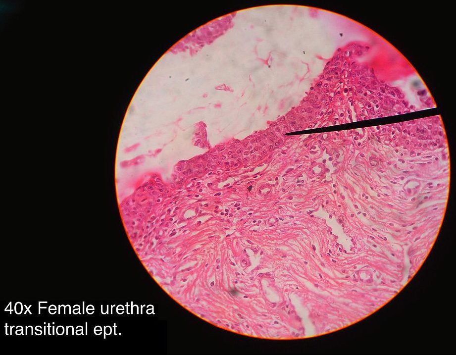 Renal Histology – UWSOM WWAMI Histopathology Thread