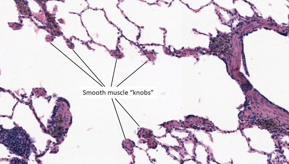 Pulmonary Histology – UWSOM WWAMI Histopathology Thread