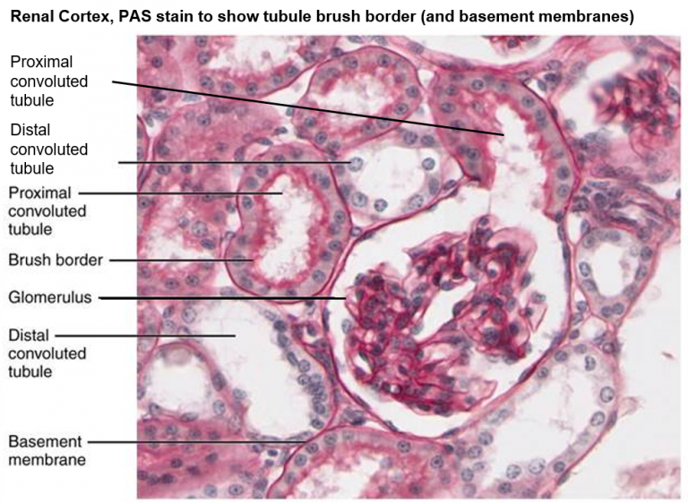 Renal Histology Uwsom Wwami Histopathology Thread