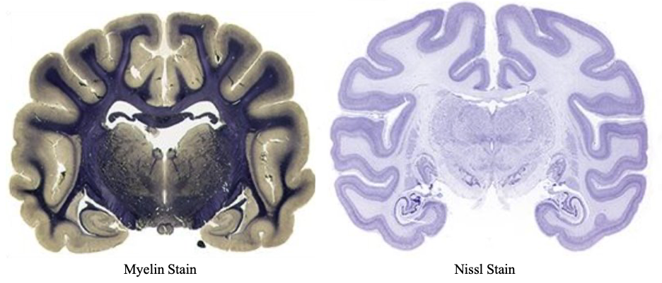 Section on the left is from a dog and that on the right is from a monkey, but they still look enough alike—and like a human brain---to make the point. ​ Both images are from neurosciencesassociates.com