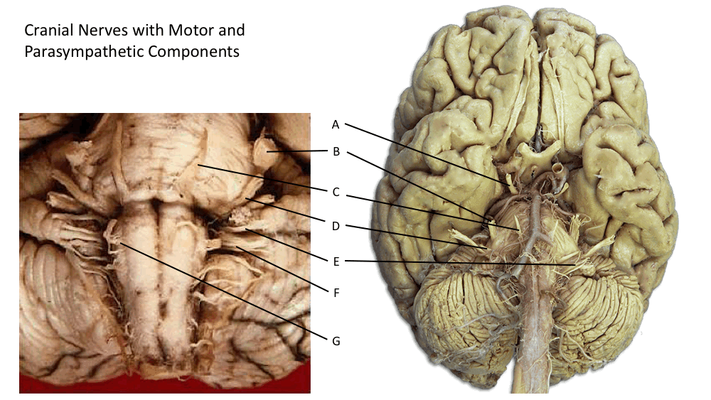 Cranial nerves with motor function