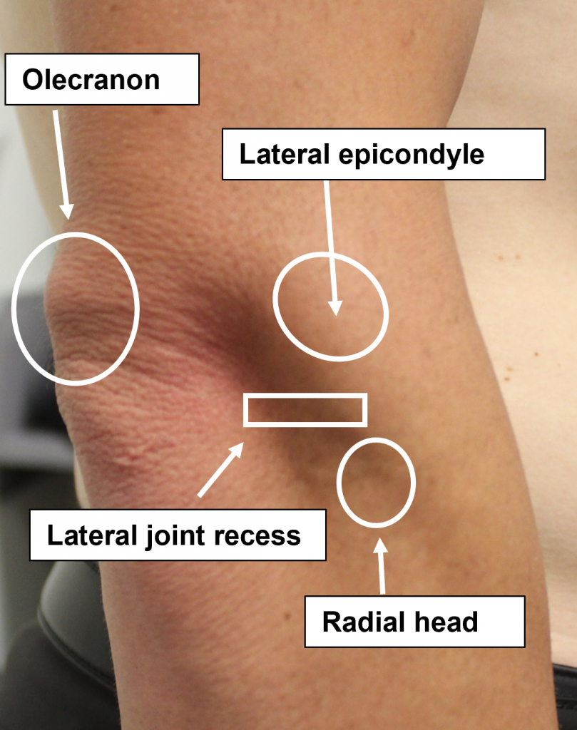 Right elbow– Lateral view