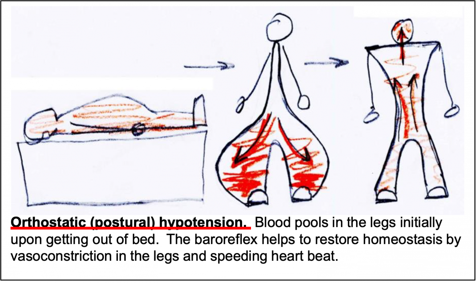 Orthostatic Hypotension – Autonomic Nervous System Physiology