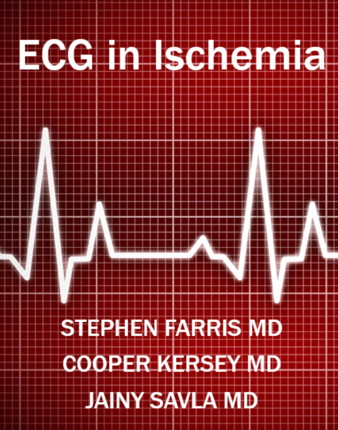 Cover image for CVS ECG Tutorial 3