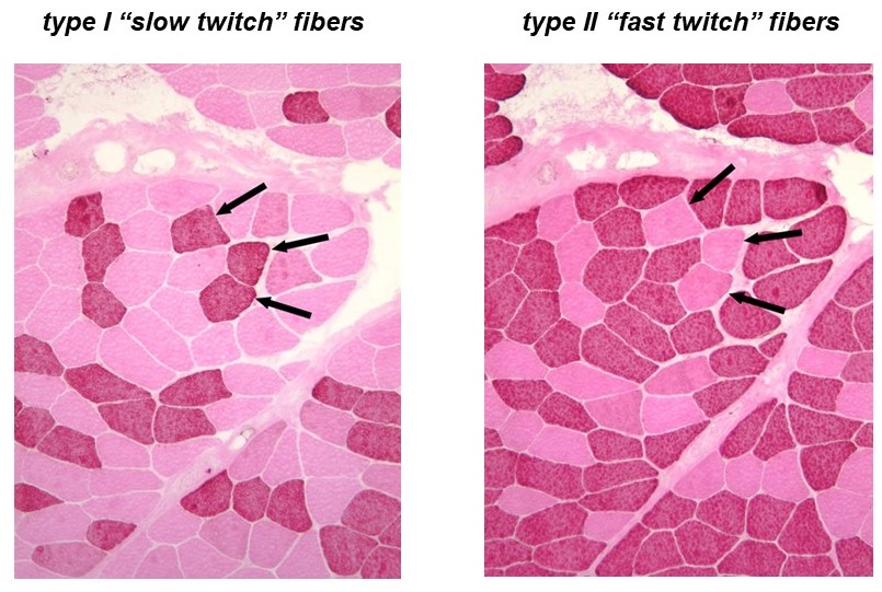 Skeletal muscles are mosaics consisting of mixtures of slow- and fast-twitch fibers