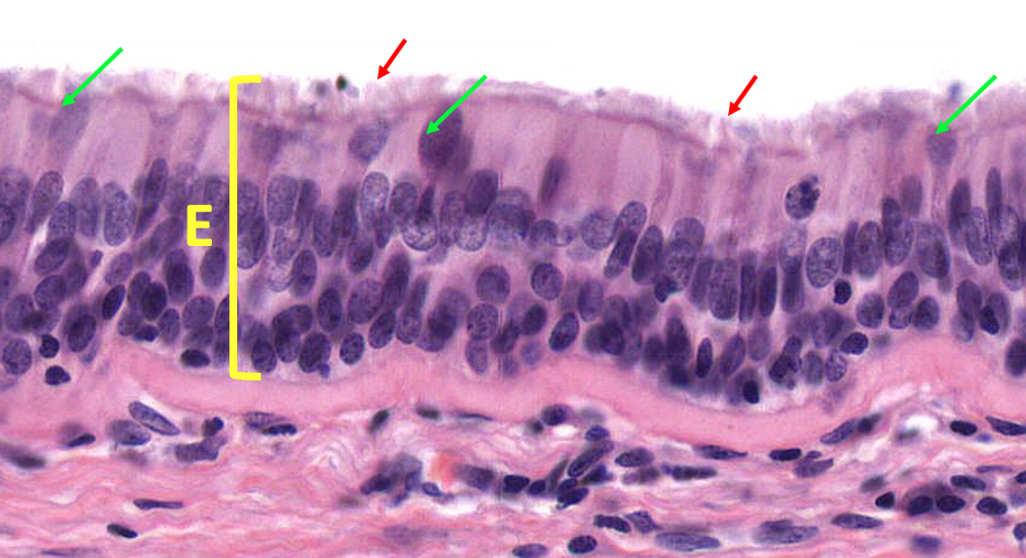 high magnification view of pseudostratified ciliated epithelium