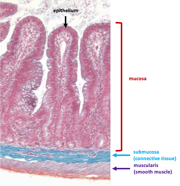 wall of intestine showing layers: mucosa, submucosa, and muscularis