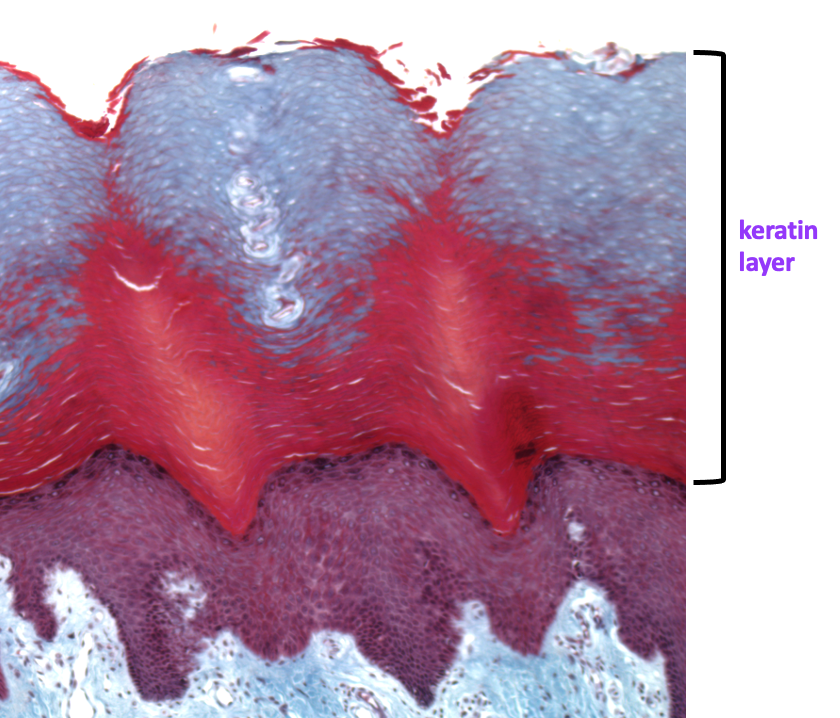 high magnification view of epidermis showing keratinocytes (purple) and keratin layer (red and blue)