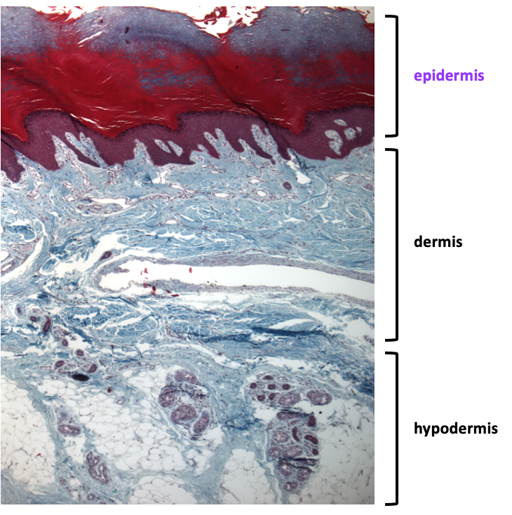 low magnification section of thick skin showing epidermis, dermis, and hypodermis