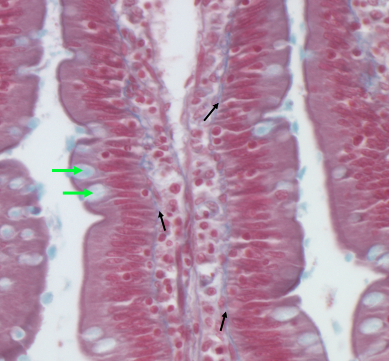 simple columnar epithelium of intestine at high magnification