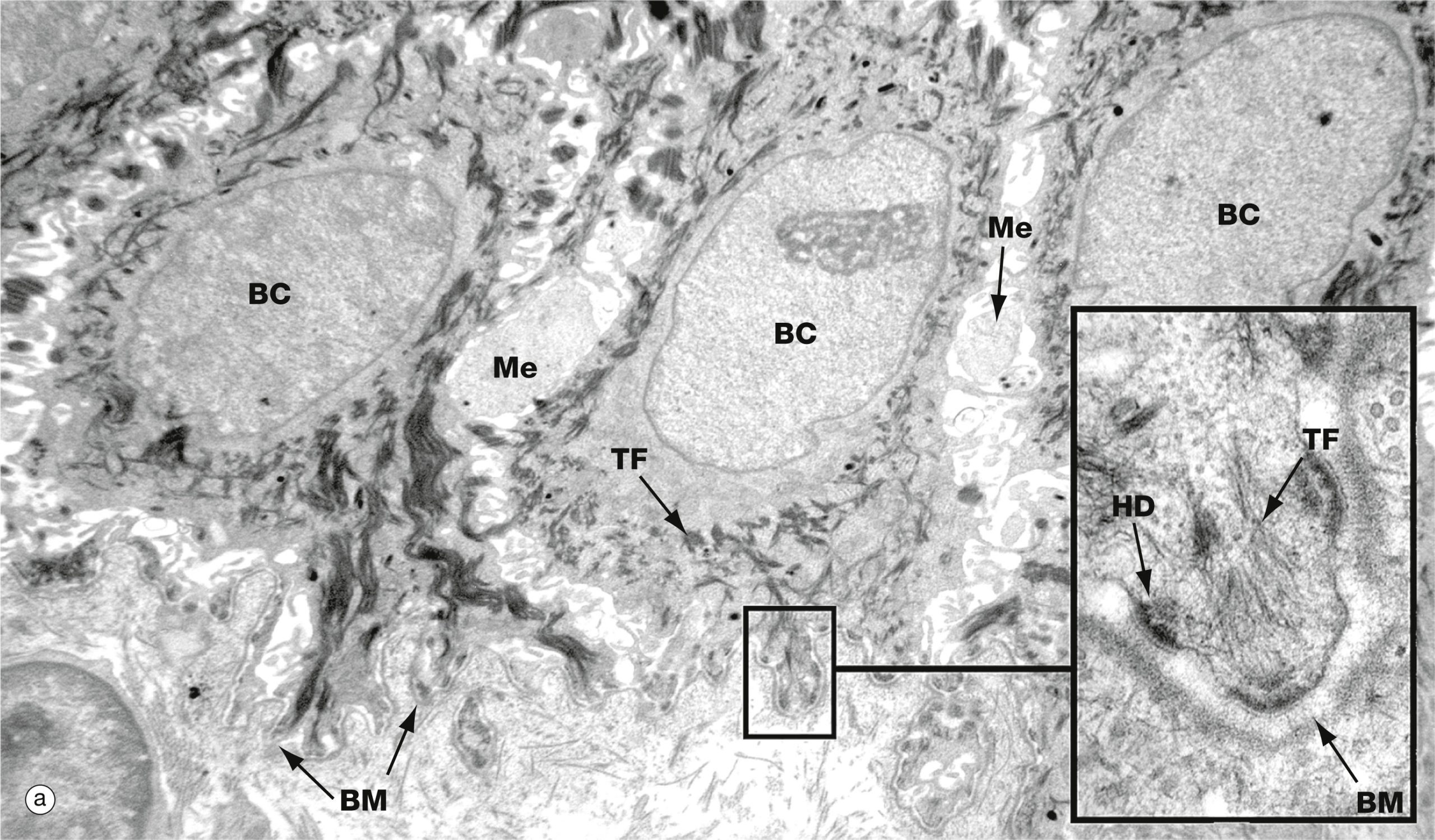 electron micrograph of basal surface of epidermis showing basement membrane