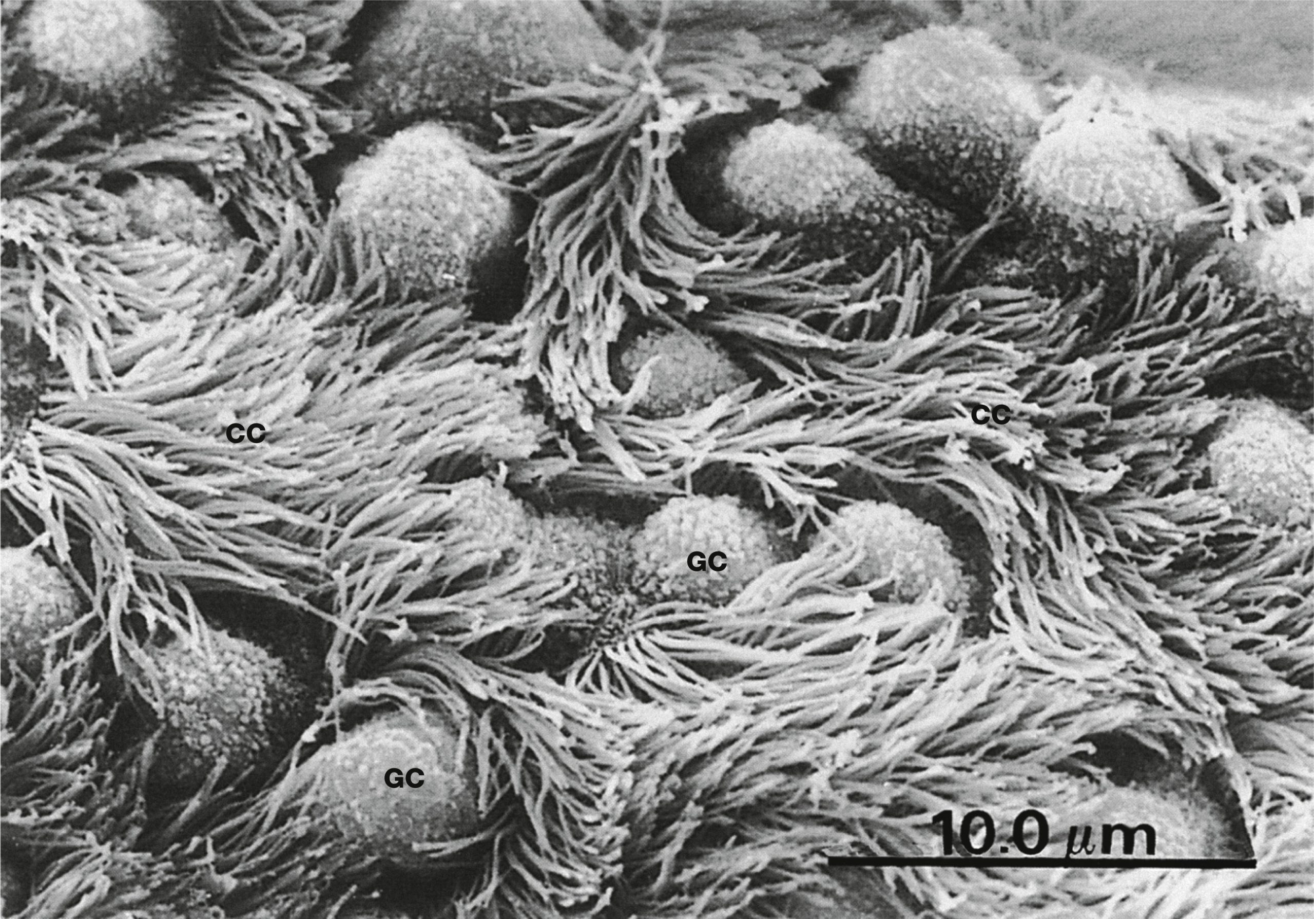 scanning EM showing cilia and goblet cells on the surface of the airway epithelium in the primary bronchus