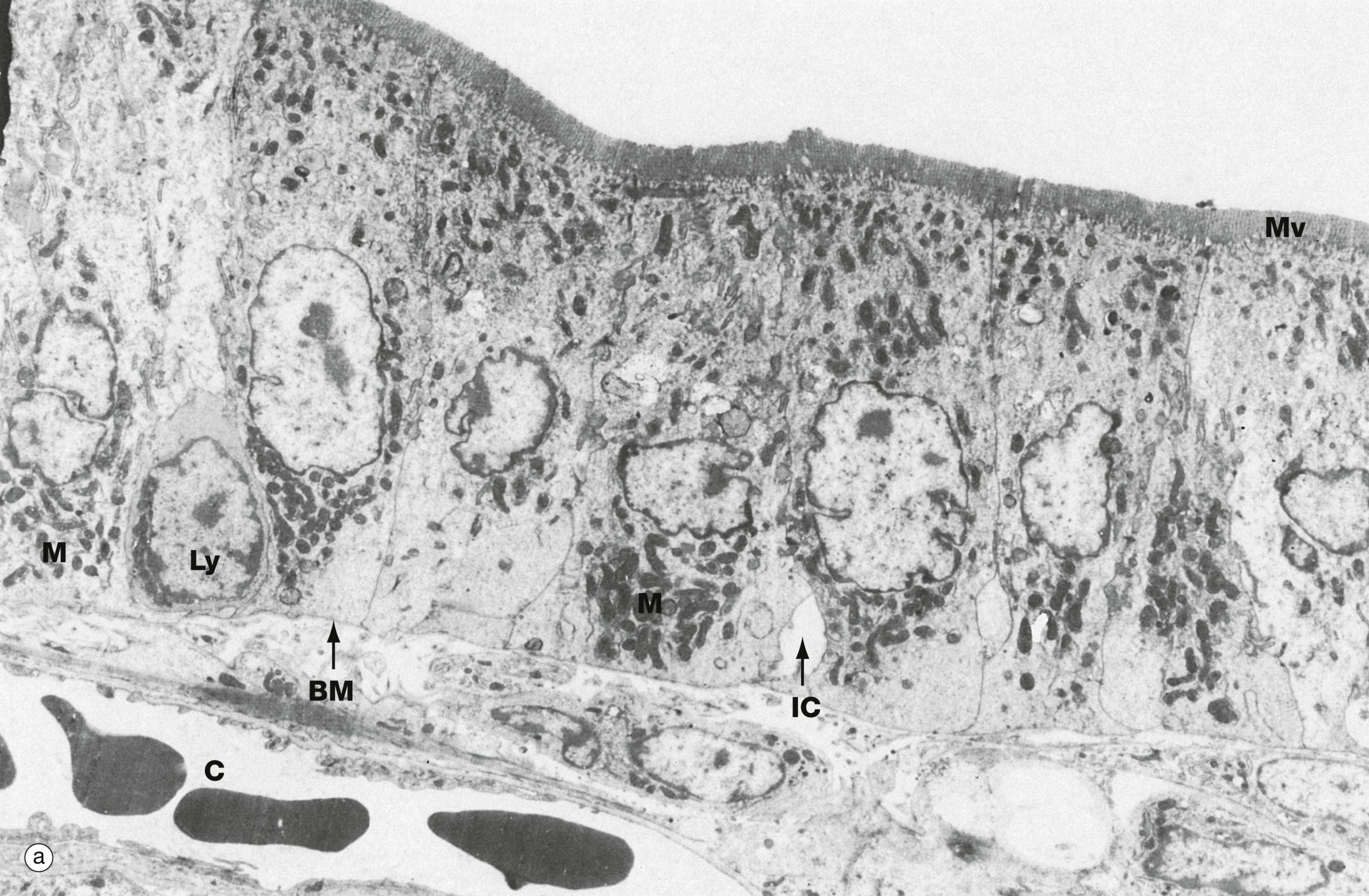 electron micrograph of enterocytes