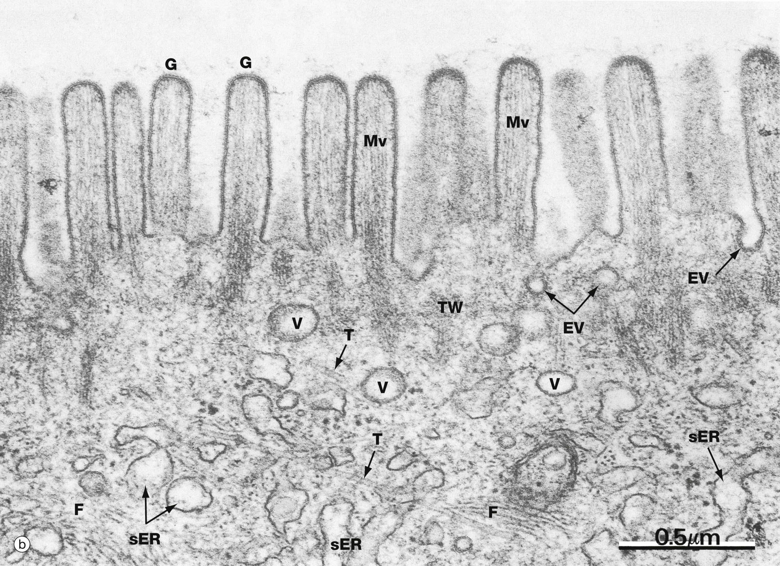 electron micrograph showing microvilli