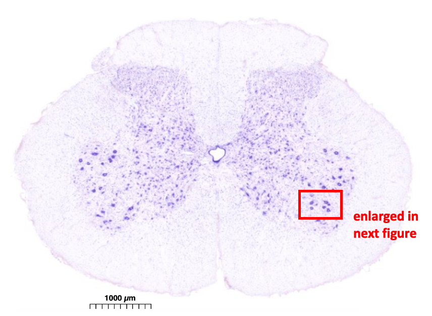 section of spinal cord stained with Nissle stain to show purple cell bodies