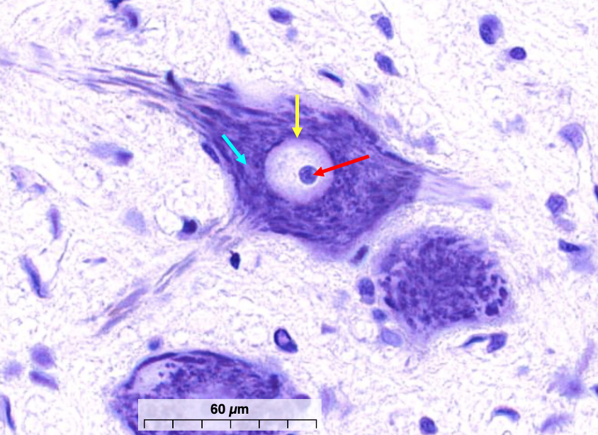 neuronal cell body with arrows showing rough ER (cyan arrow), nucleus (yellow arrow) and nucleolus (red arrow)