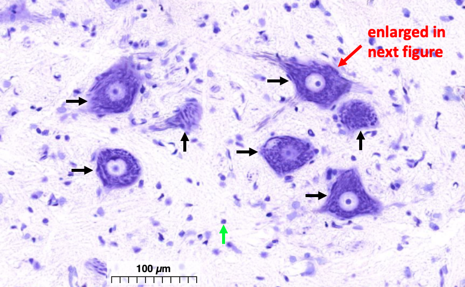 large purple neuronal cells bodies in a section of the spinal cord