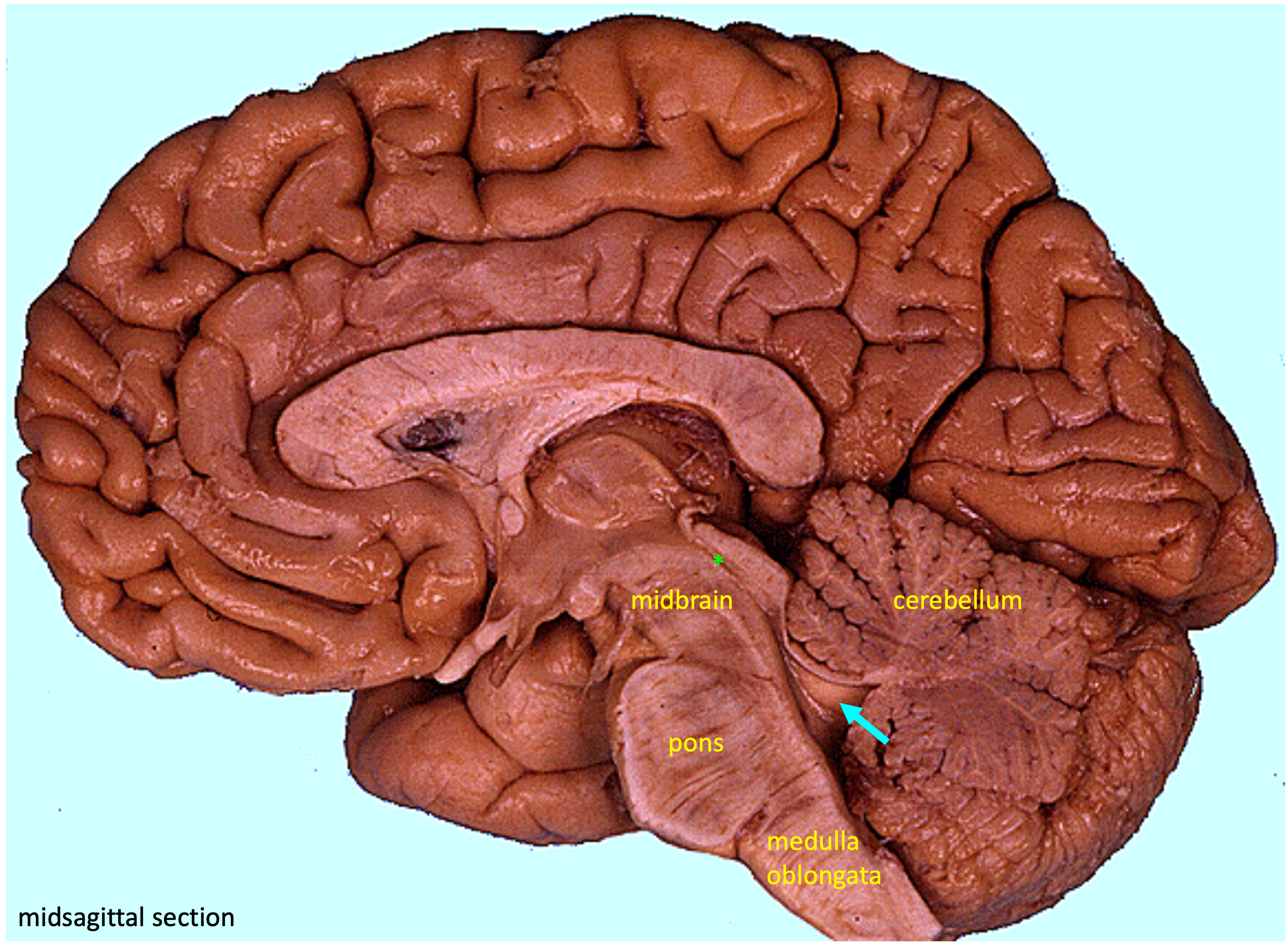 midsagittal section showing brainstem and cerebellum