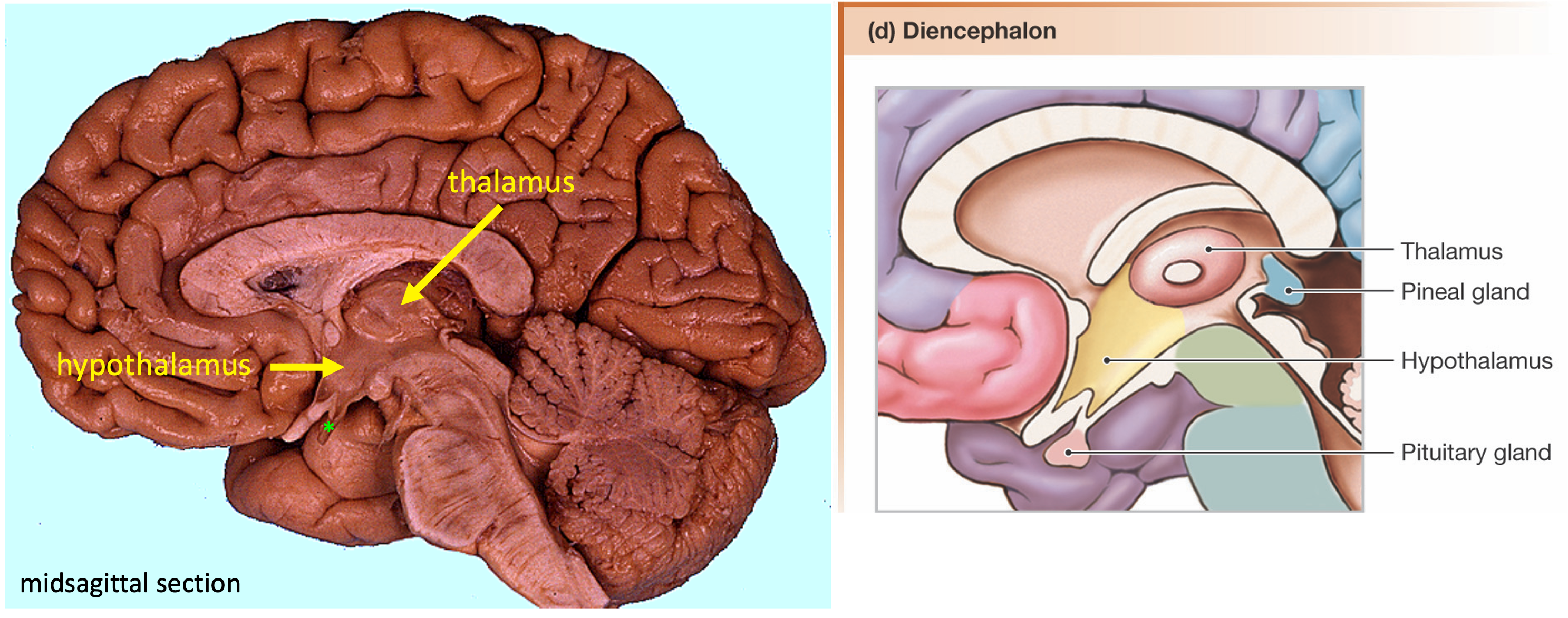 photo and schematic of the diencephalon in a midsagittal section of the brain