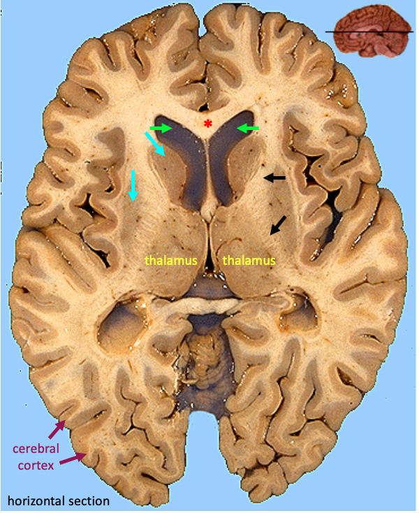 horizontal section of the brain showing gray matter and white matter