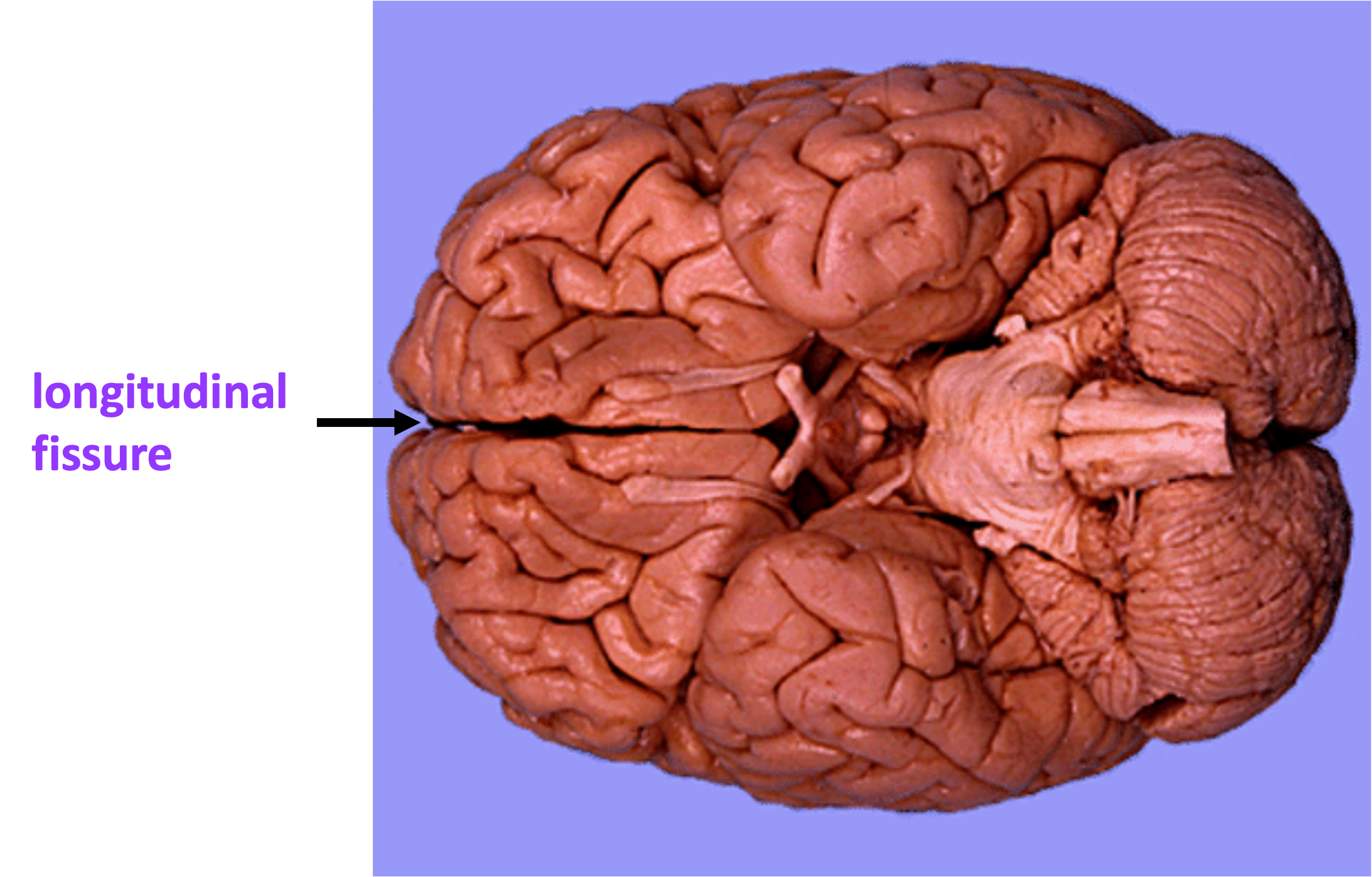 inferior view of human brain indicating longitudinal fissure between the two cerebral hemispheres