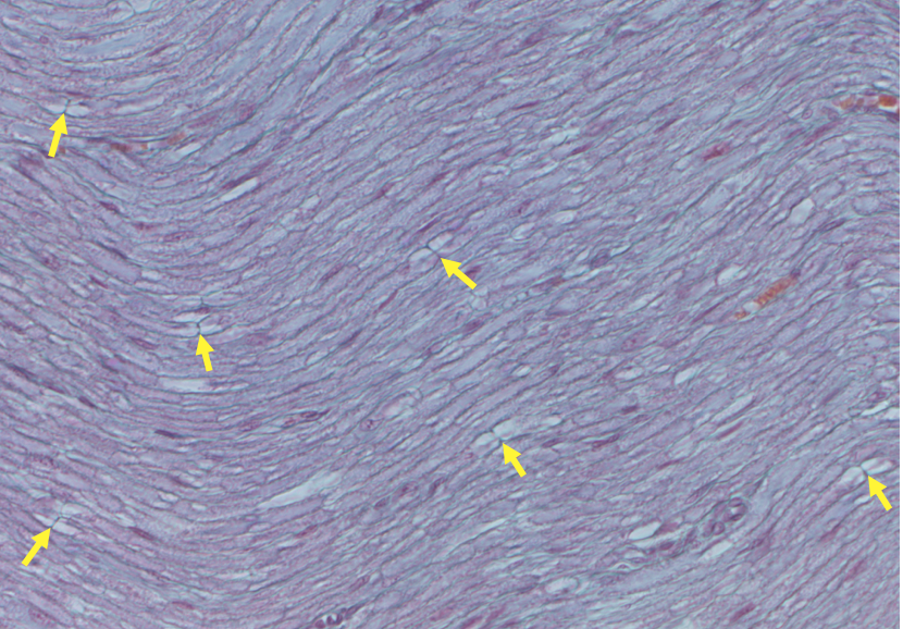 longitudinal section of a peripheral nerve