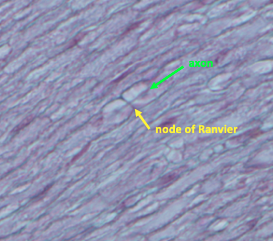 high magnification of nerve showing node of Ranvier (yellow arrow) and axon (green arrow)