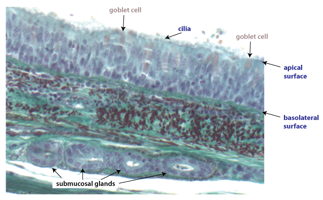 airway tissue in the trachea