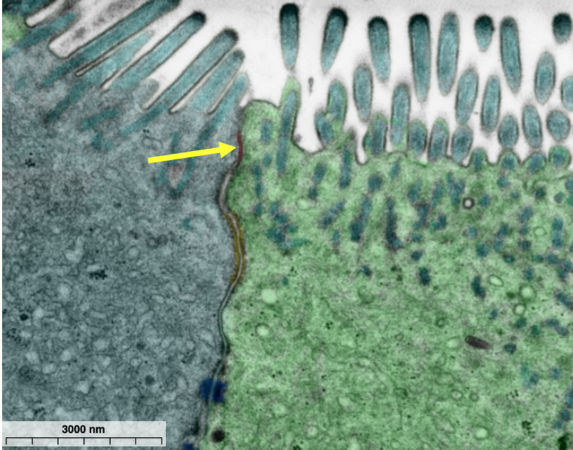 electron micrograph of intestinal cells showing a tight junction