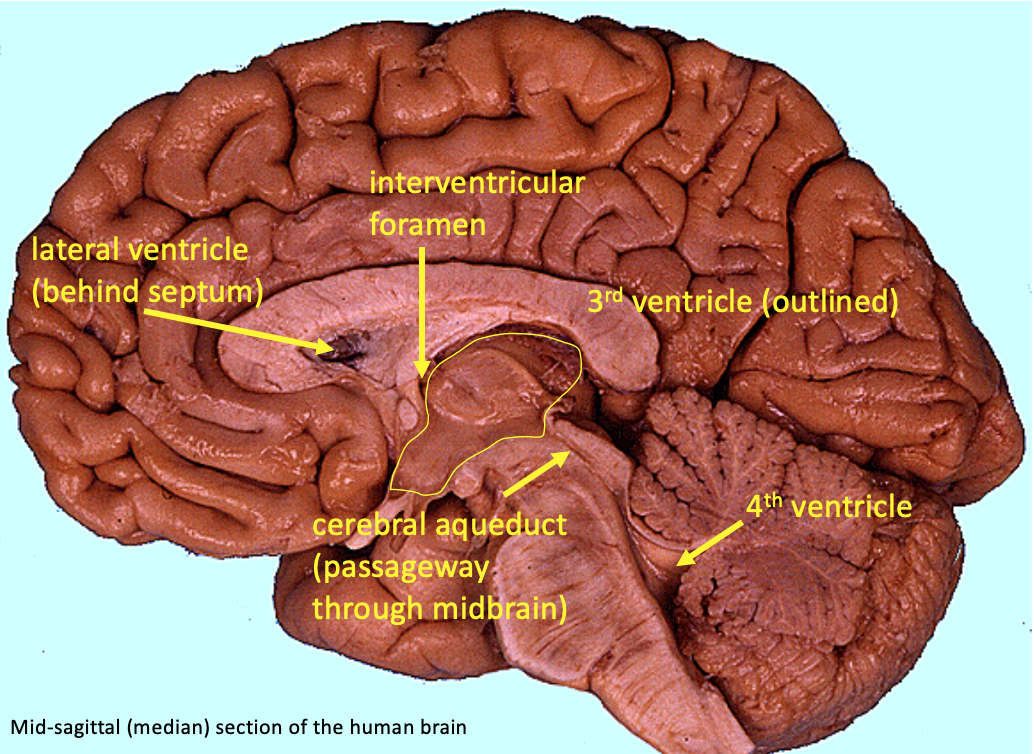 median section of brains showing the ventricles and passageways that connect them