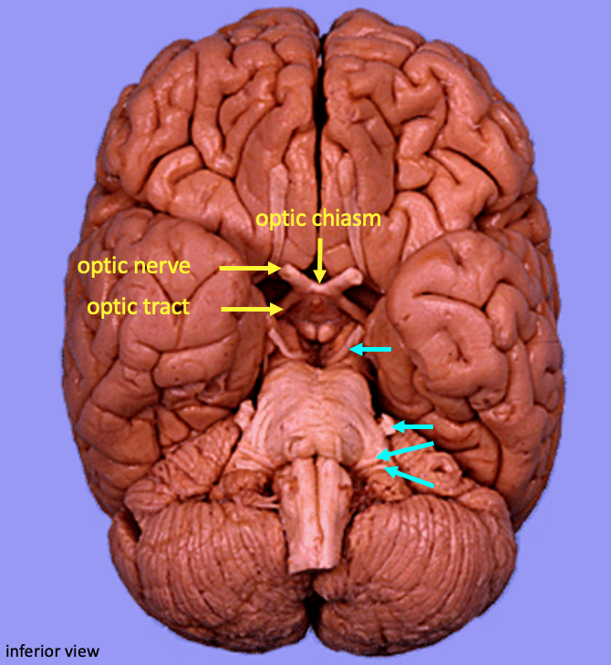 inferior view of the brain showing visual pathways and cranial nerves