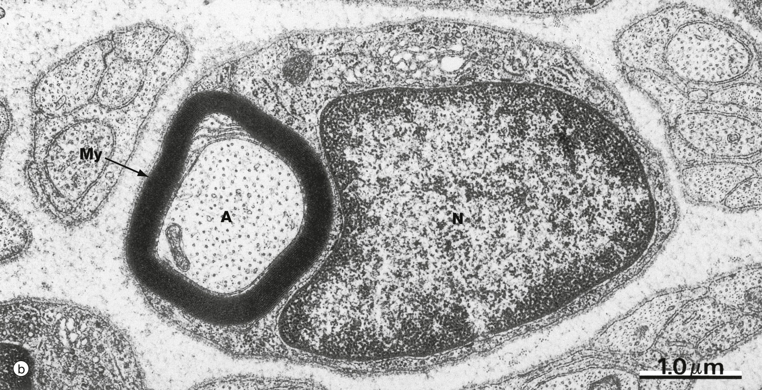 electron micrograph of a cross-section of a myelinated axon in the peripheral nervous system