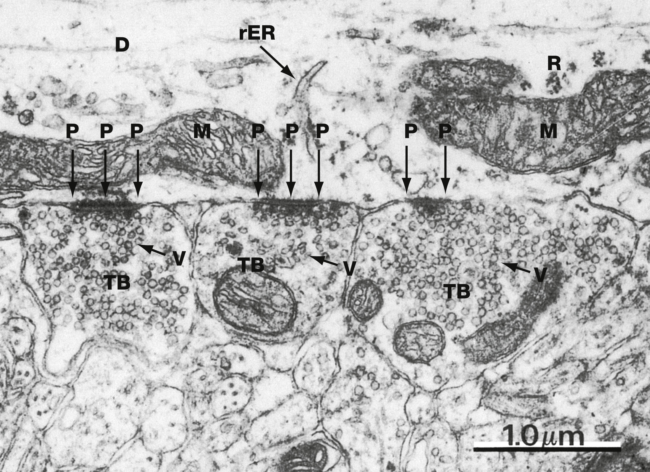 three chemical synapses showing synaptic vesicles and postsynaptic densities