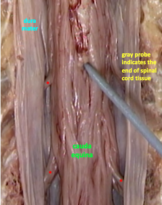 distal end of the spinal cord showing the cauda equina