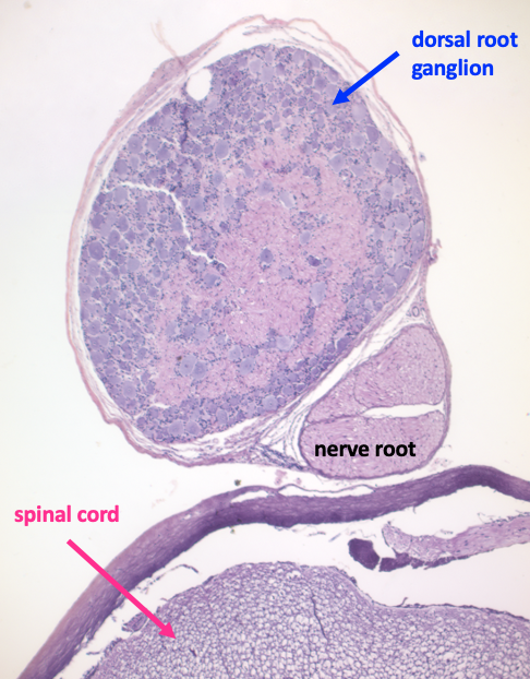 low magnification view of a dorsal root ganglion next to a nerve root and the edge of the spinal cord