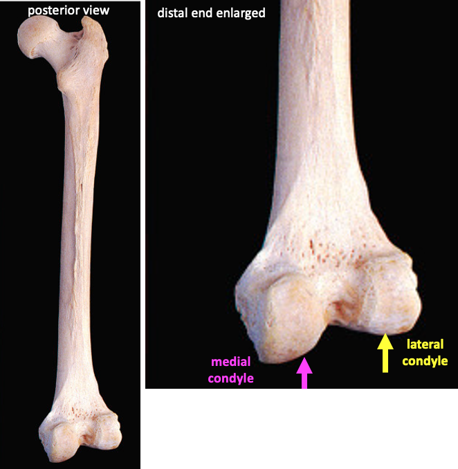 posterior view of full femur (left) and enlarged version (right) showing medial and lateral condyles