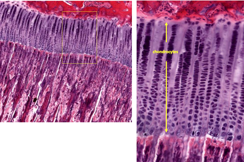 higher magnification views of the epiphyseal growth plate. The dividing cells in the purple region are chondrocytes.