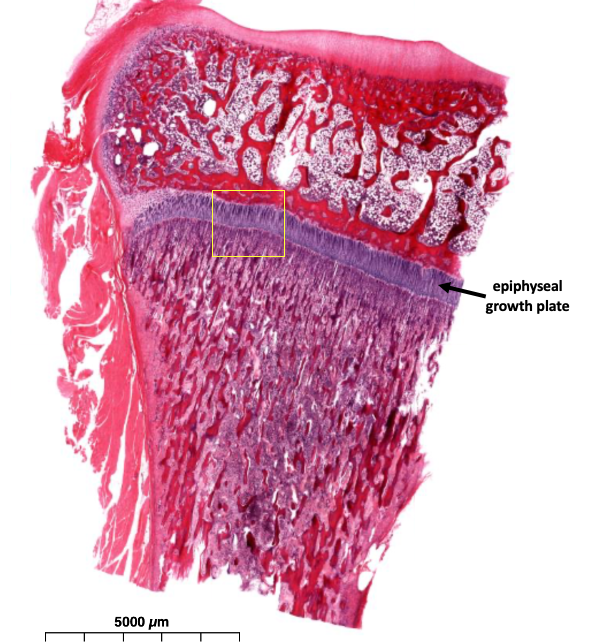 section of growing bone showing epiphyseal growth plate