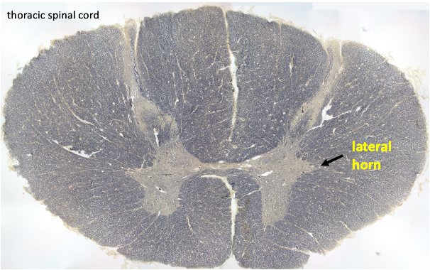 section of thoracic spinal cord showing lateral horn