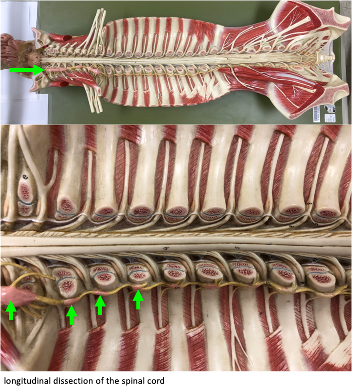 longitudinal dissection of the spinal cord full (above) and enlarged (below) showing the sympathetic chain ganglia