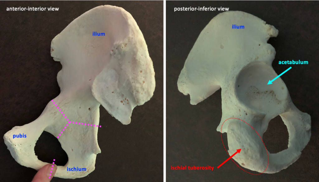 interior view (left) and posterior-inferior view (right) of the hip bone, with lines to show the divisions between the three bones