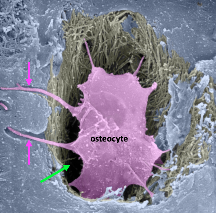 pink osteocyte inside a lacuna with processes extending away from the cell