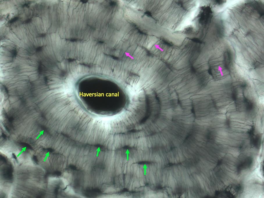 single osteon from compact bone at high magnification to show lacunae (green arrows) and canaliculi (pink arrows)