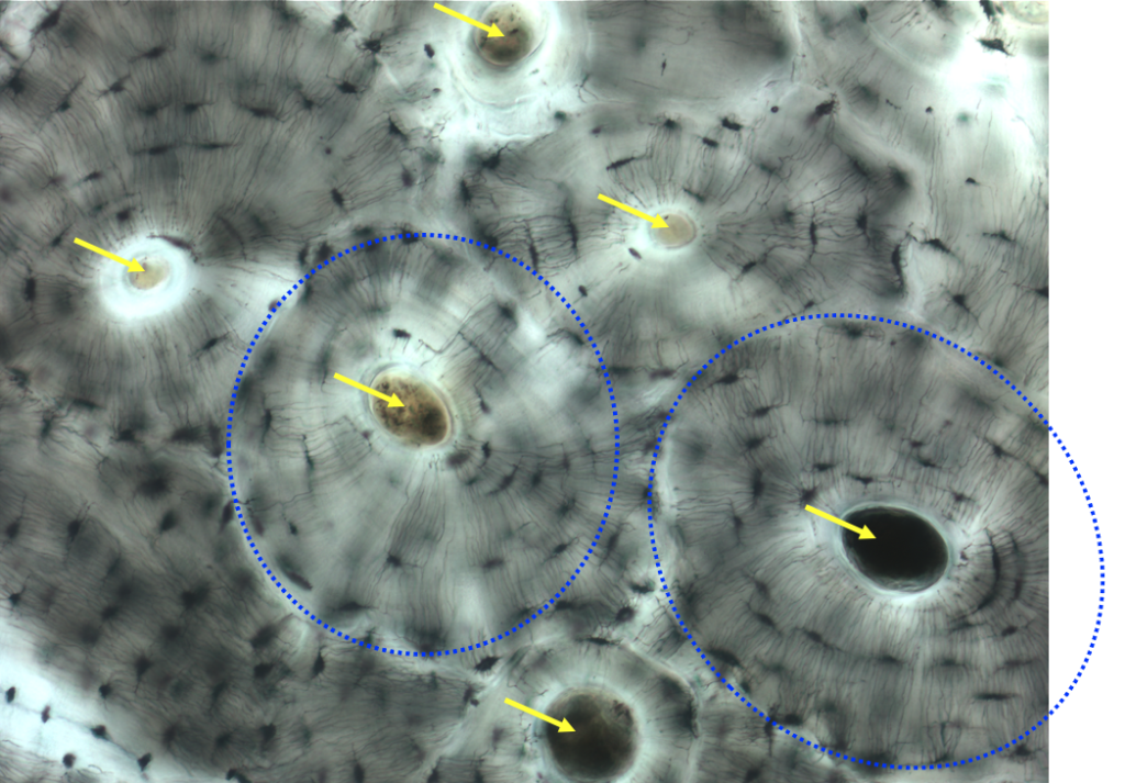 compact bone showing osteons