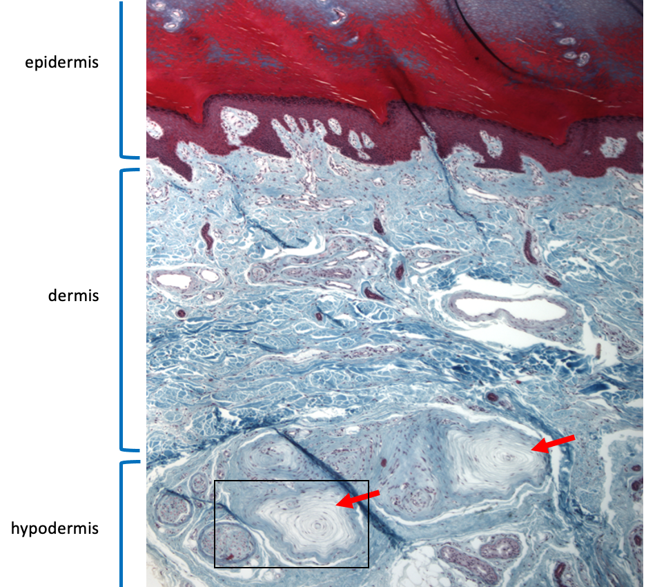 layers of skin at low magnification showing pacinian corpuscles in the hypodermis