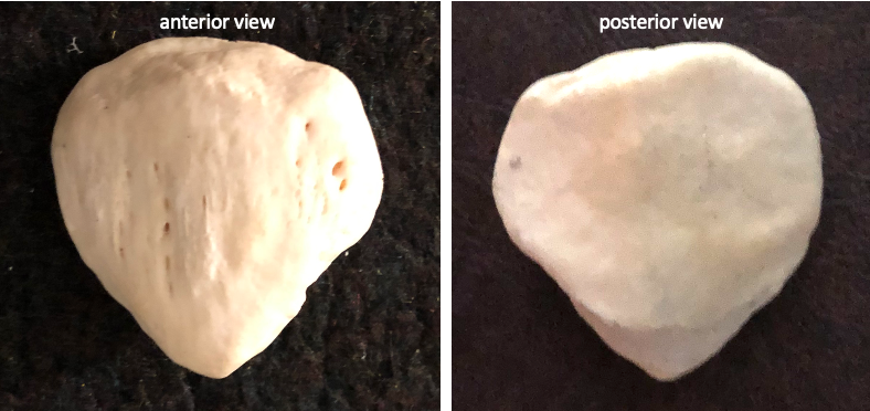 anterior (left) and posterior (right) views of the patella