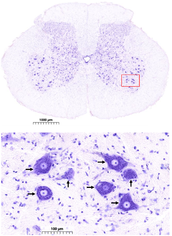 section of the spinal cord (top) with enlarged region showing cell bodies of somatic motor neurons in the ventral horn