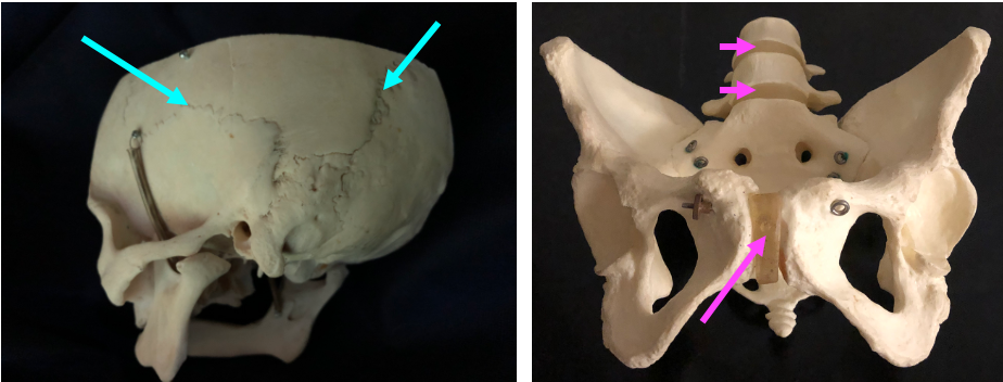 (left) back of skull with cyan arrow showing sutures, anterior view of pelvis and lower back model with pink arrows indicating intervertebral discs and pubic symphysis